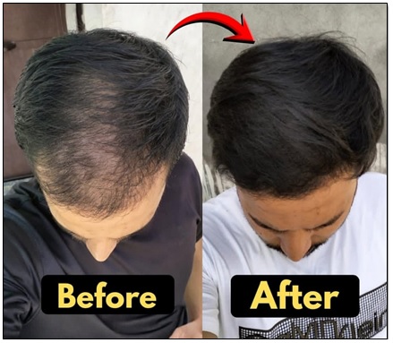 Aloe Vera Hair Grow Gel - Premium Quality 100gm - Image 2
