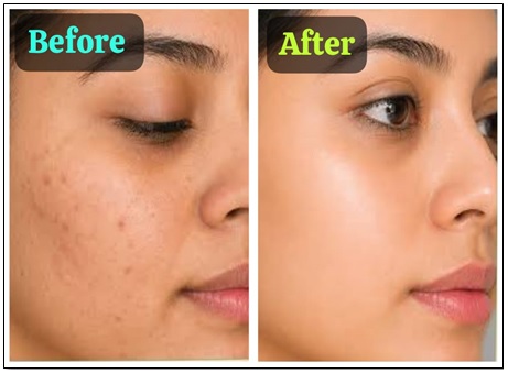 Aloe Vera Papaya Face Gel - Premium Quality 100gm - Image 4