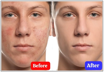 Aloe Vera Papaya Face Gel - Premium Quality 100gm - Image 3