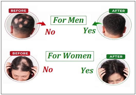Aloe Vera Hair Grow Gel - Premium Quality 100gm - Image 3