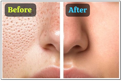 Aloe Vera Papaya Face Gel - Premium Quality 100gm - Image 5